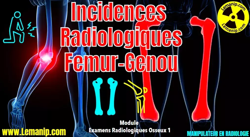 Étapes examen IRM genou