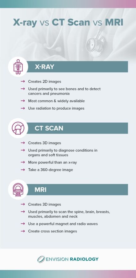 Comparaison scanner et IRM