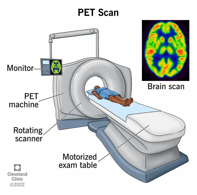 IRM et scanner contrastes