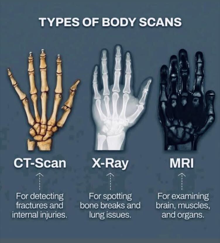 Comparaison scanner et IRM