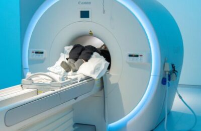 Prix d&rsquo;une IRM avec ordonnance : Ce qu&rsquo;il faut savoir