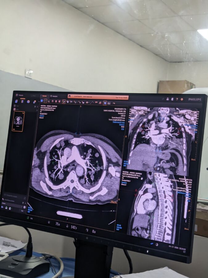 scanner thoracique organes visibles