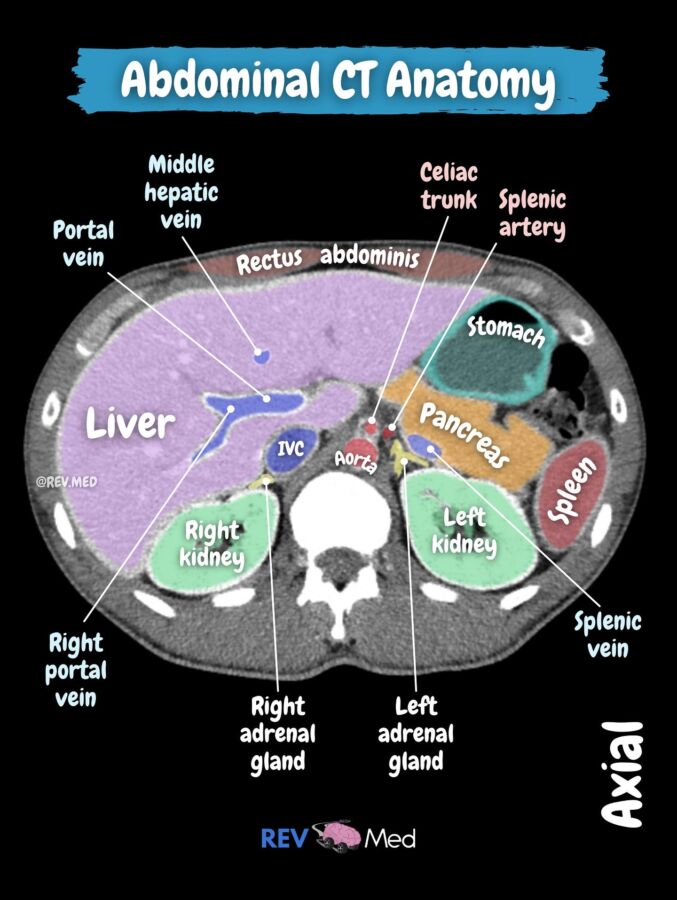 organes observés scanner thorax