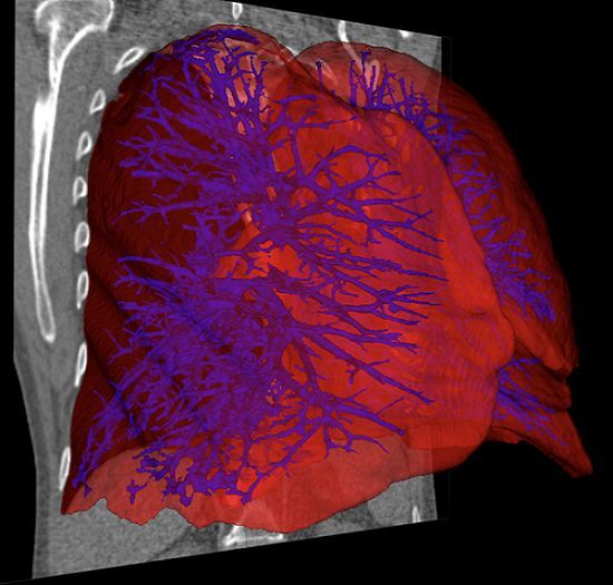 organes observés scanner thorax