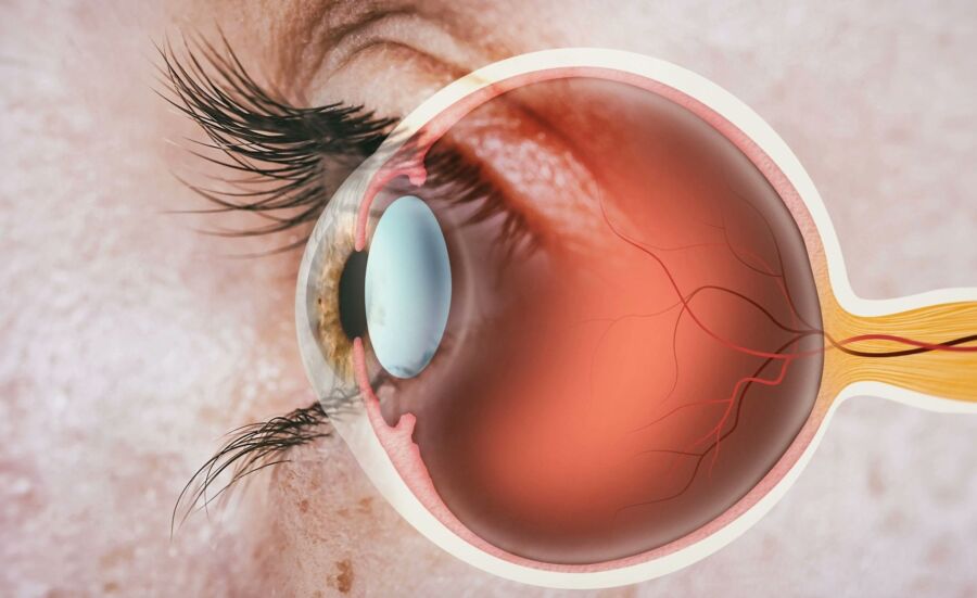 Procédure IRM des yeux