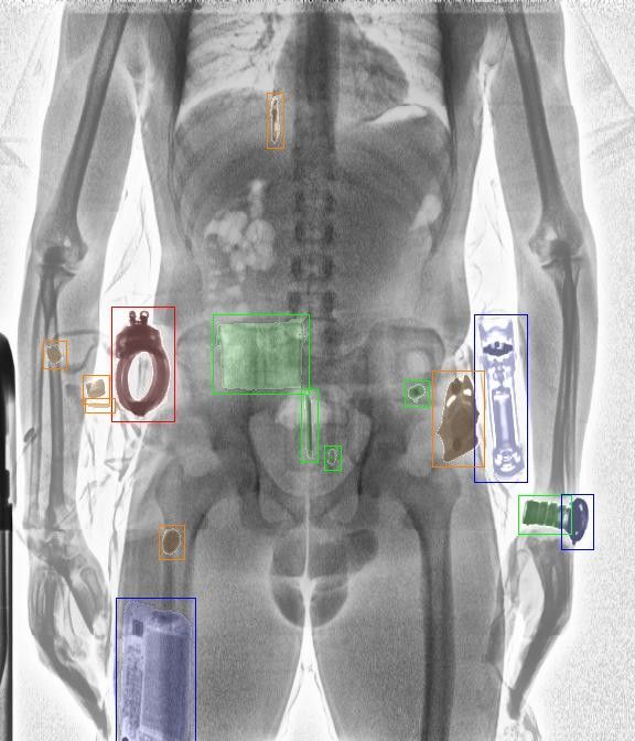 Cancer visible scanner abdominal