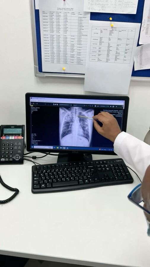 Détection cancer scanner abdominal
