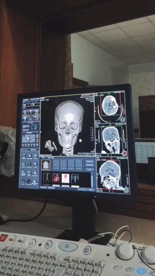 déshabillage scanner abdominal