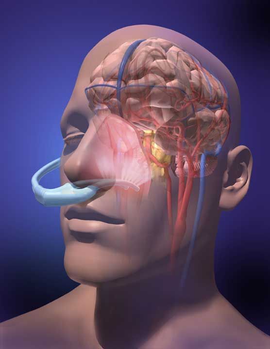 Durée scanner des sinus