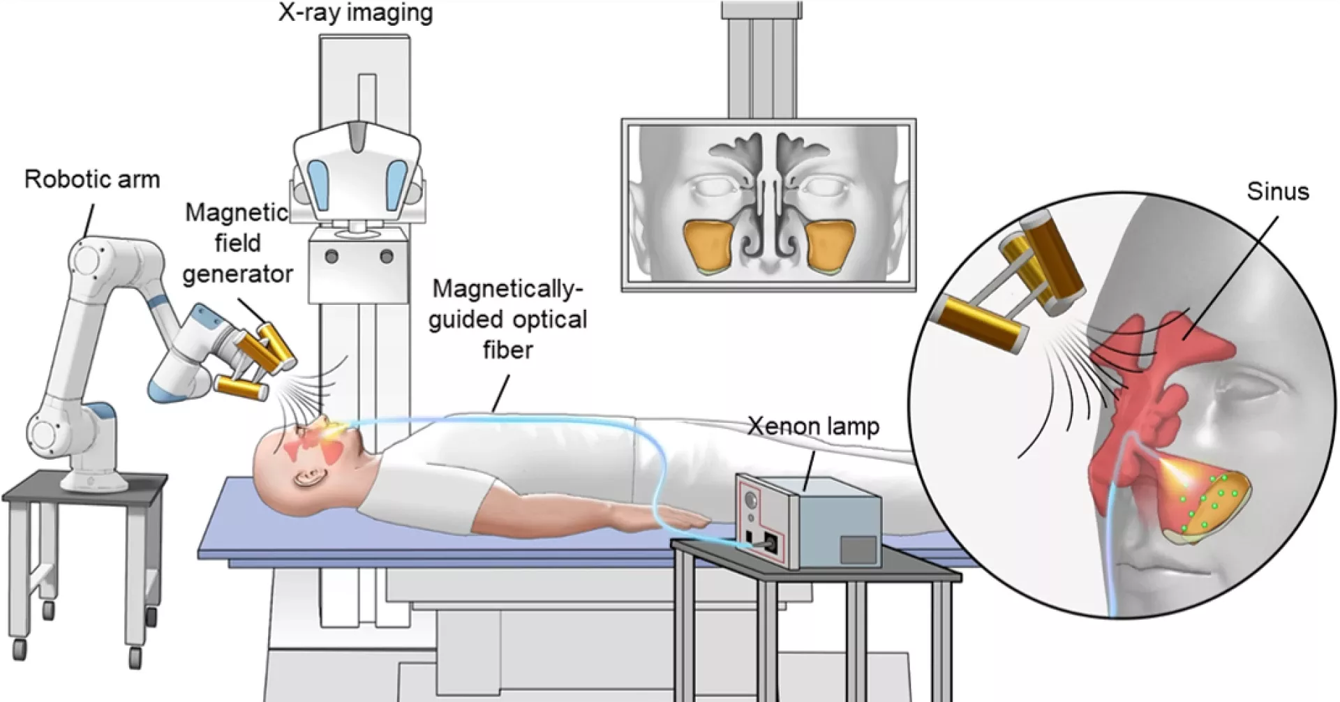 Combien de temps pour scanner sinus