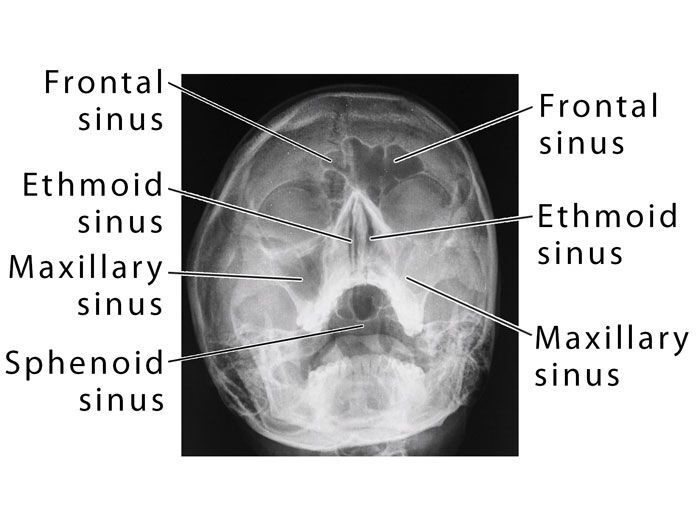 Temps nécessaire scanner sinus