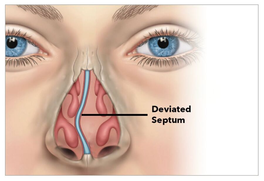 Combien de temps pour scanner sinus