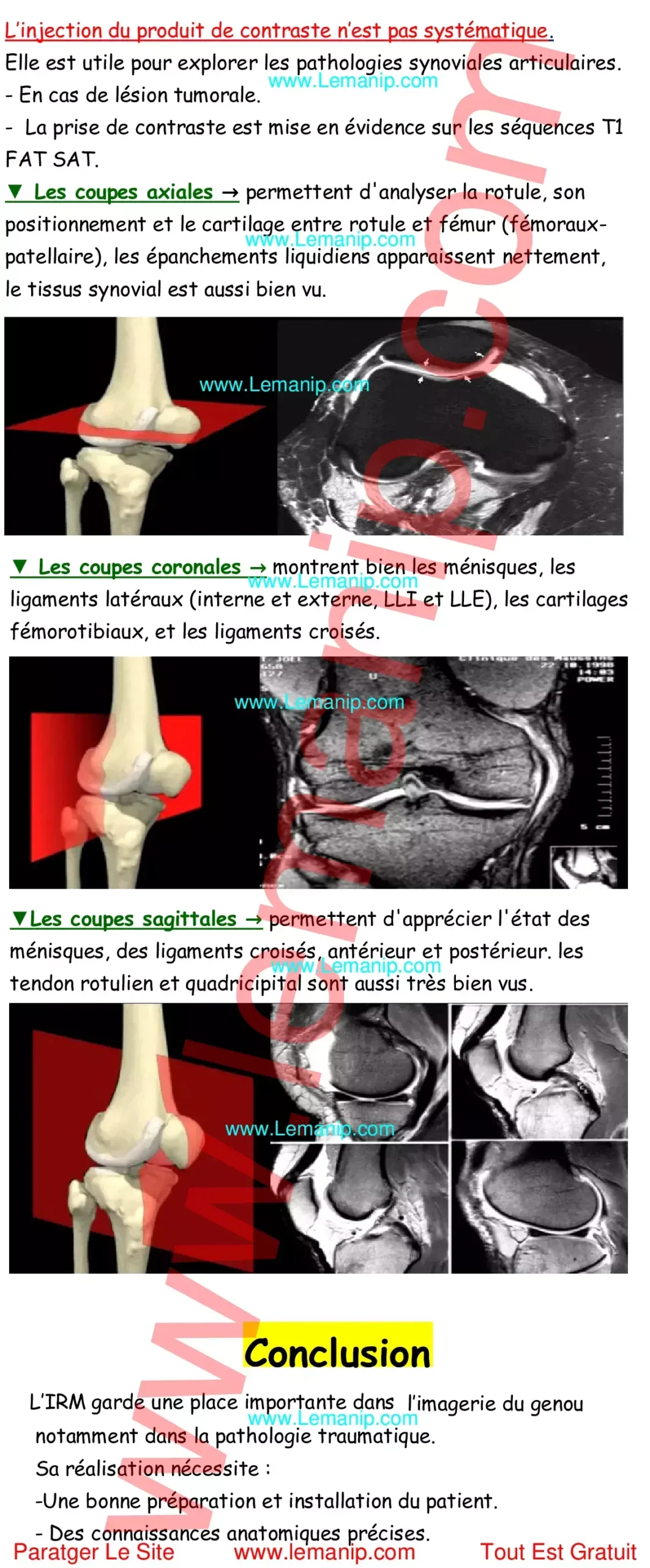 Genou IRM espace ouvert