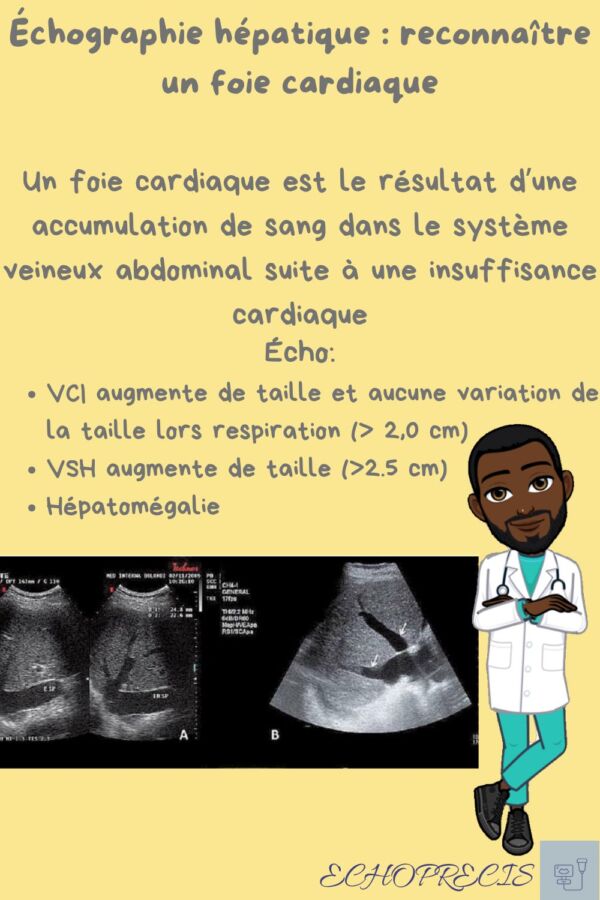 Préparation échographie abdominale