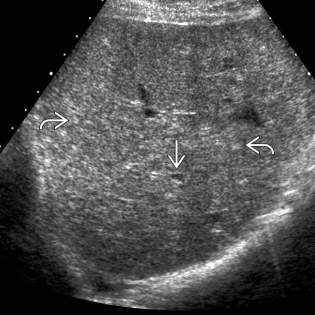 Étapes échographie abdominale
