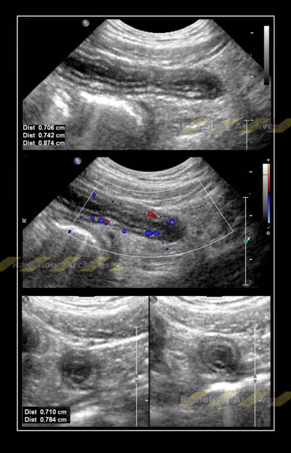 Conseils pour échographie abdominale