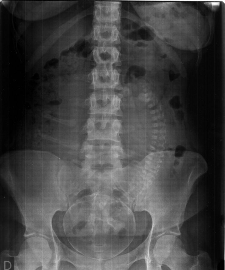 Préparation échographie abdominale
