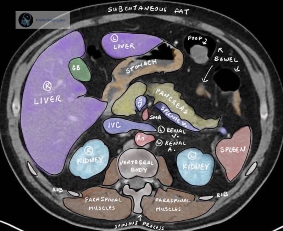 Vue organes échographie abdominale