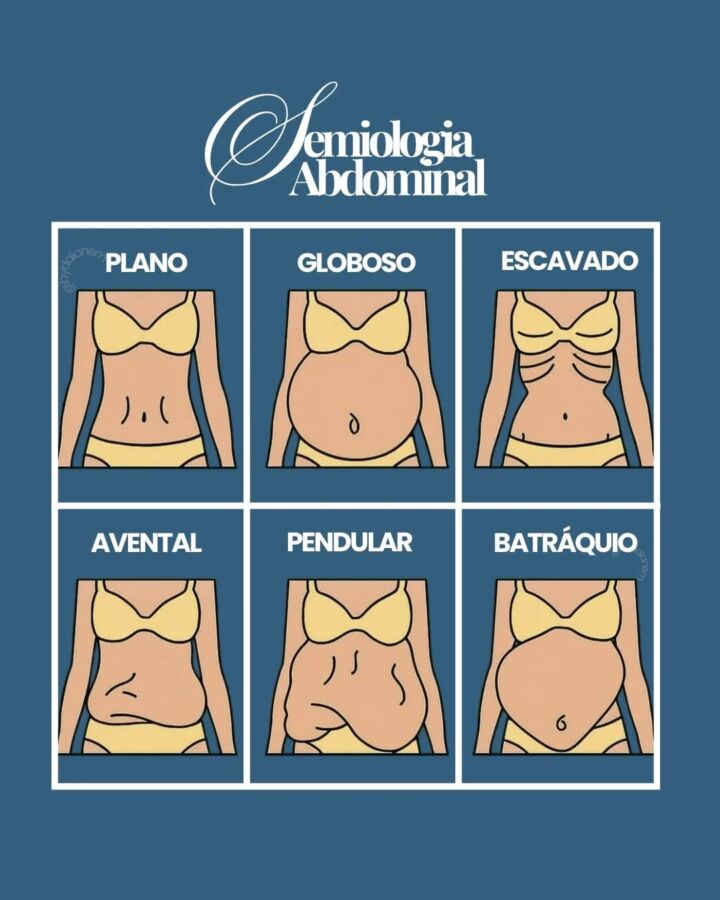 Organe échographie abdominale