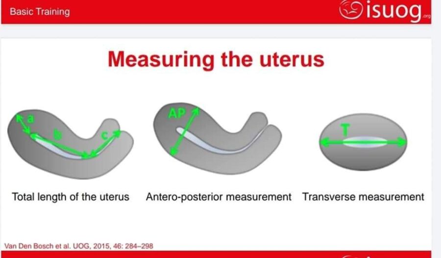 Vue organes échographie abdominale