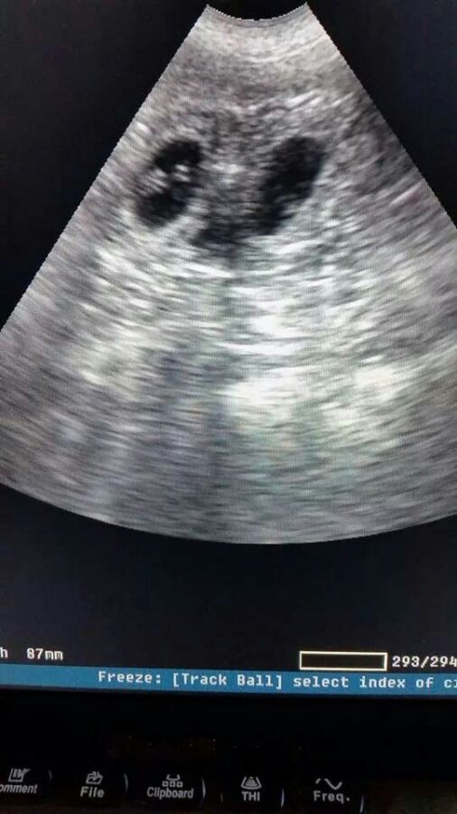 Coût échographie cardiaque chien